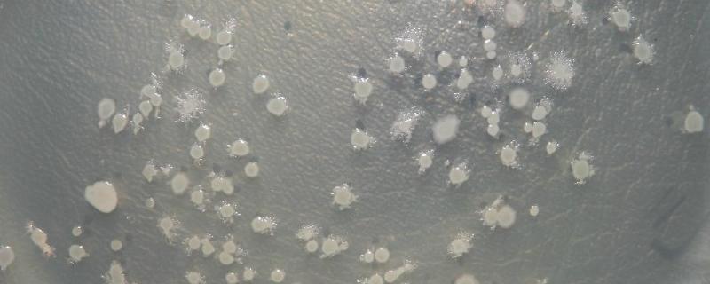 什么情况下使用芽孢菌调水芽孢菌多少度能杀死